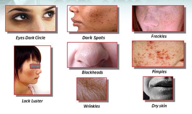 Facial Skin Problems - Skin Issues Solved